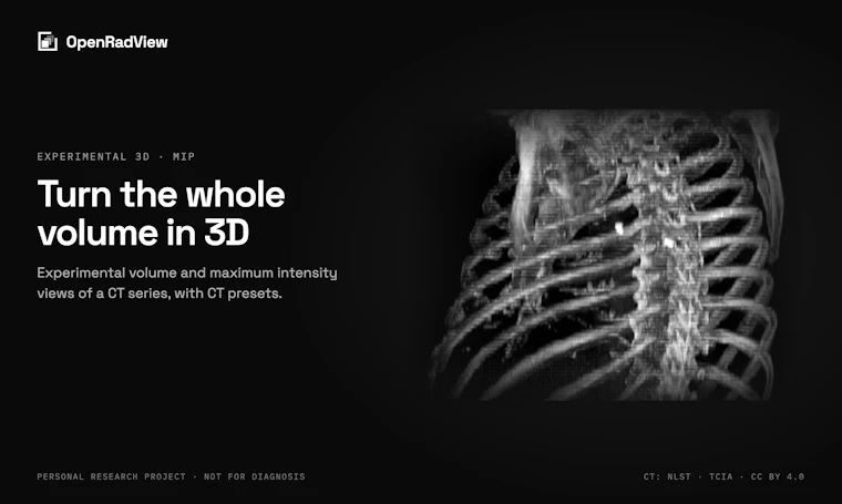 OpenRadView - 免费开源的CT、MRI与X光片个人影像查看器 产品图片 2