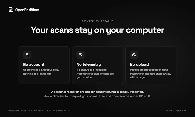 OpenRadView - 免费开源的CT、MRI与X光片个人影像查看器 产品图片 4